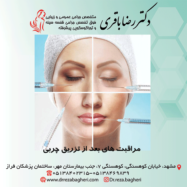 مراقبت های بعد از تزریق چربی متخصص جراحی عمومی و زیبایی دکتر رضا باقری