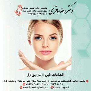 اقدامات قبل از تزریق ژل